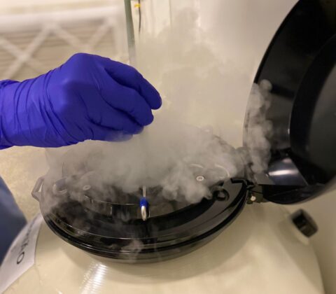 Imagem do post Novembro Azul: congelamento de sêmen é alternativa contra risco de infertilidade causada por tratamentos oncológicos