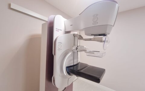 Imagem do post CAM oferece 300 mamografias gratuitas: saiba como agendar