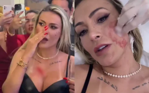 Imagem do post Andressa Urach surge nas redes sociais e revela motivo de briga com Juju Ferrari