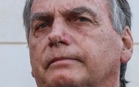 Imagem do post Bolsonaro operado? Ex-presidente faz laparotomia exploradora