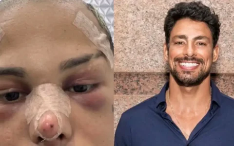 Imagem do post Influenciador gasta R$ 100 mil em cirurgias para ficar “parecido” com galã da Globo e gera polêmica