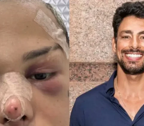 Imagem do post Influenciador gasta R$ 100 mil em cirurgias para ficar “parecido” com galã da Globo e gera polêmica