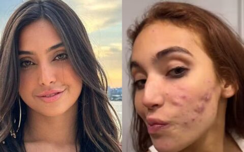 Imagem do post Vanessa Lopes faz desabafo após receber críticas sobre sua aparência