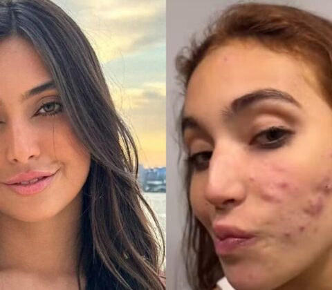 Imagem do post Vanessa Lopes faz desabafo após receber críticas sobre sua aparência