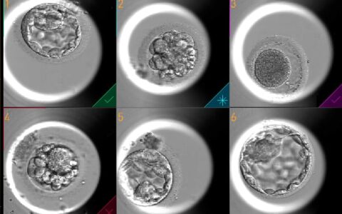 Imagem do post Inovação na reprodução assistida: empresa implanta nova tecnologia para tratamento de fertilização