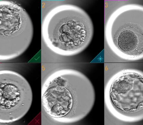 Imagem do post Inovação na reprodução assistida: empresa implanta nova tecnologia para tratamento de fertilização