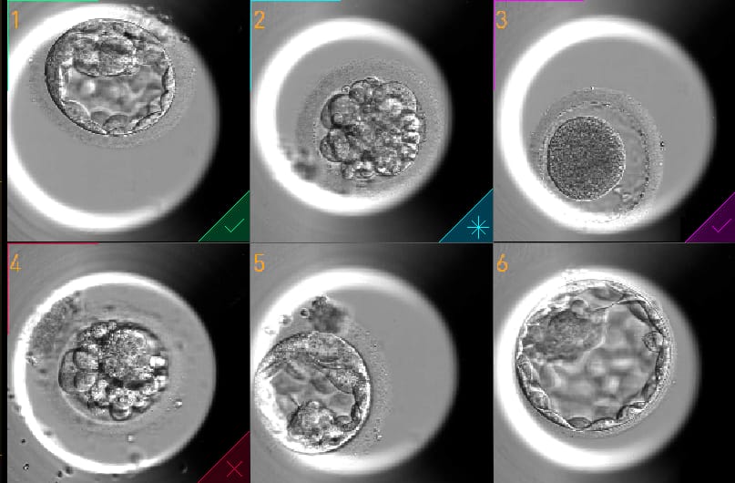 Inovação na reprodução assistida: empresa implanta nova tecnologia para tratamento de fertilização
