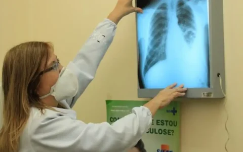 Imagem do post Brasil está na contramão da meta da OMS para extinção da tuberculose