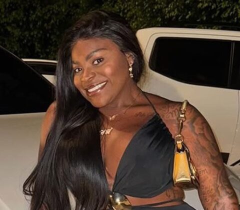 Imagem do post Jojo Todynho choca seguidores ao compartilhar “antes e depois”