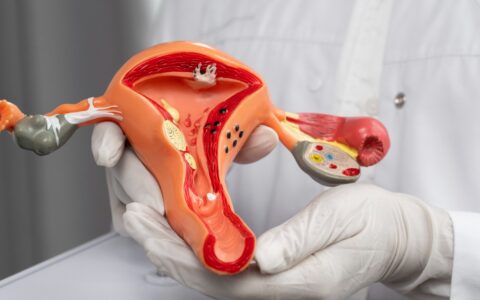 Imagem do post No mês da visibilidade para a endometriose especialista fala sobre avanços médicos no tratamento da doença