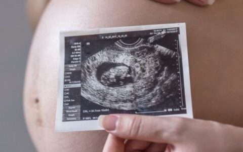 Imagem do post Dia Internacional da Tireoide: distúrbios podem afetar fertilidade