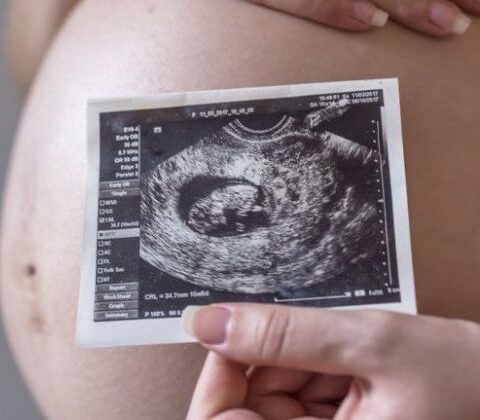 Imagem do post Dia Internacional da Tireoide: distúrbios podem afetar fertilidade