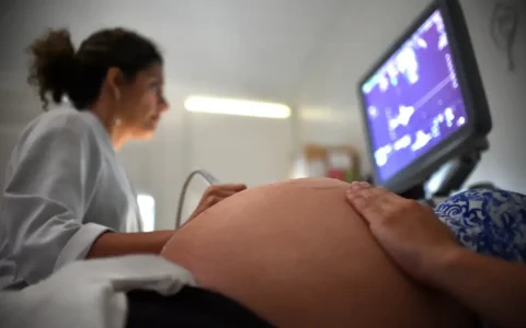 Imagem do post Apesar de evitáveis, mortes maternas por hipertensão persistem no país