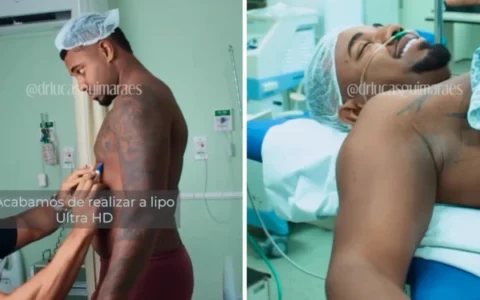 Imagem do post Davi Brito passa por cirurgia estética e divulga resultado; confira