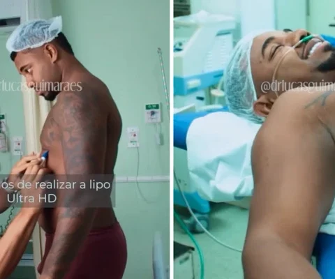 Imagem do post Davi Brito passa por cirurgia estética e divulga resultado; confira