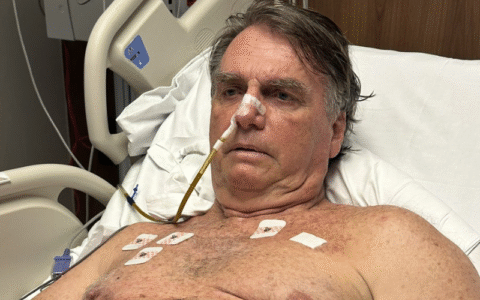Imagem do post Bolsonaro mostra cicatriz após nova cirurgia e segue internado na UTI: “Recuperação estável”