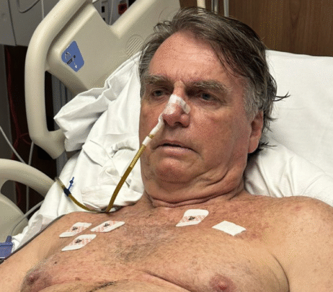Imagem do post Bolsonaro mostra cicatriz após nova cirurgia e segue internado na UTI: “Recuperação estável”