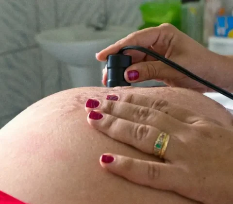 Imagem do post OMS: 300 mil mulheres morrem anualmente em razão de gravidez ou parto