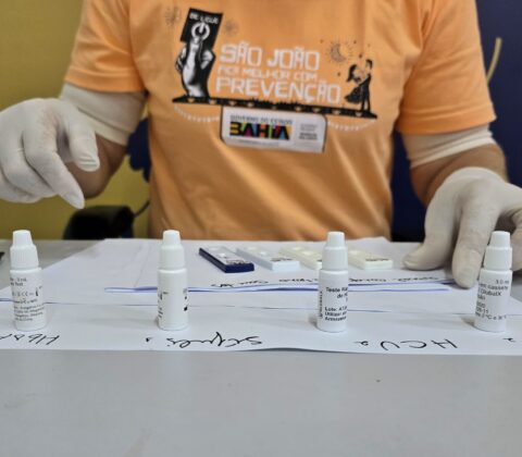 Imagem do post Itapedro: posto de testagem de IST supera marca de 3 mil exames