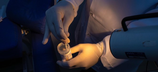 Brasil substitui papanicolau por exame de DNA-HPV no SUS