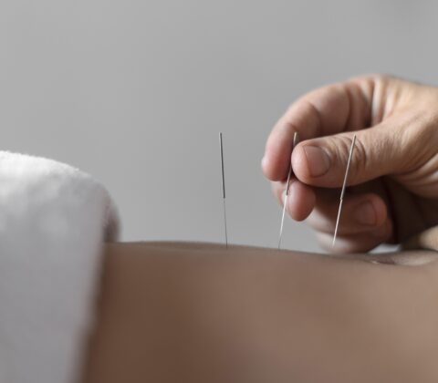 Imagem do post Salvador sedia grande evento médico sobre tratamento da dor com foco em acupuntura