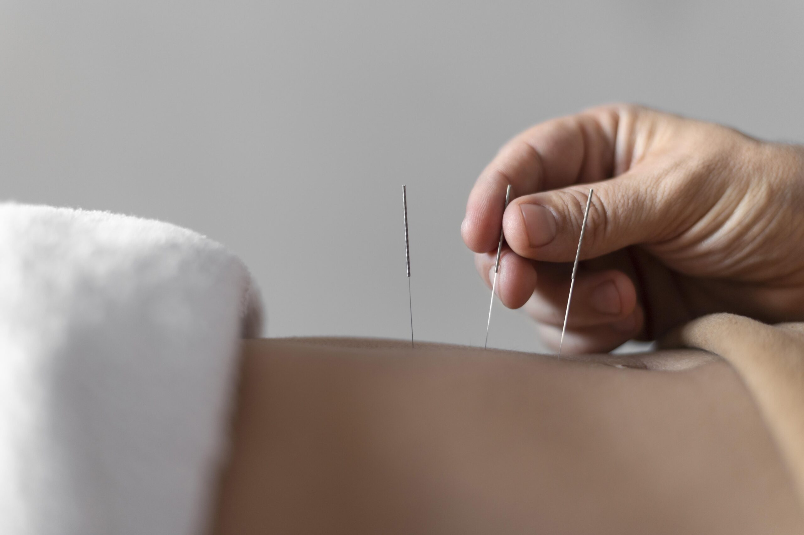 Salvador sedia grande evento médico sobre tratamento da dor com foco em acupuntura