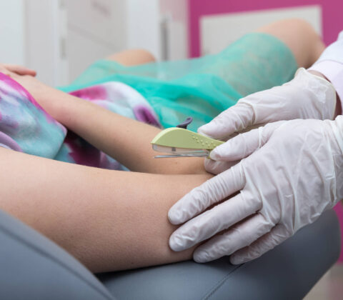 Imagem do post Secretária de Saúde municipal disponibiliza implante contraceptivo