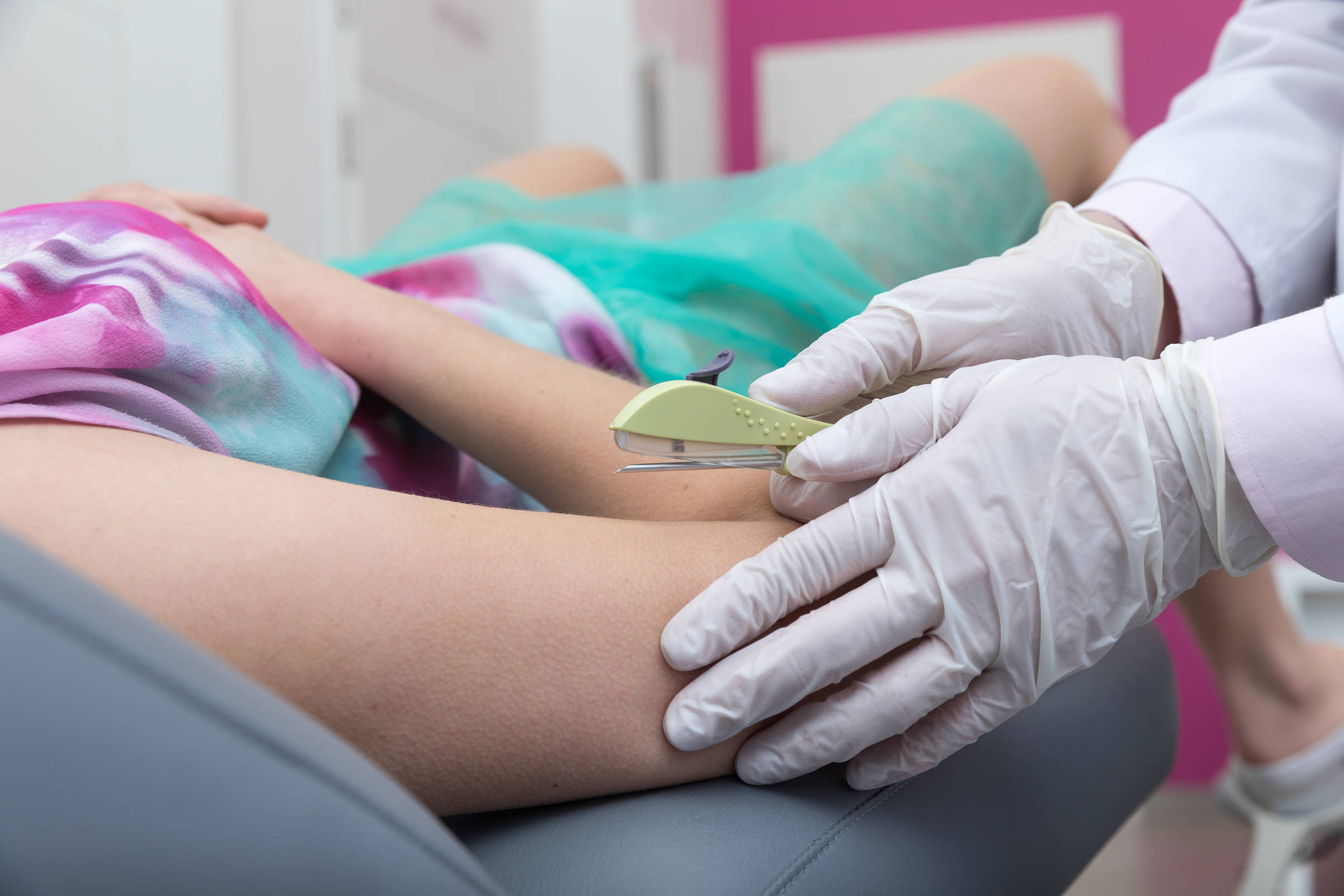 Secretária de Saúde municipal disponibiliza implante contraceptivo
