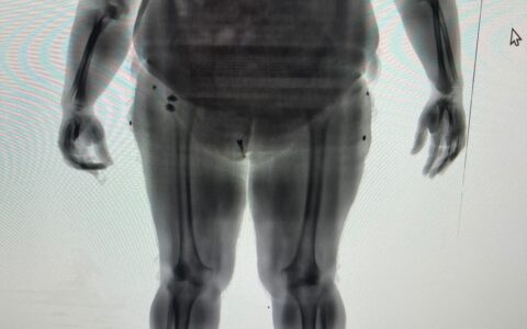 Imagem do post BodyScan flagra mulher tentando entrar com drogas no Conjunto Penal