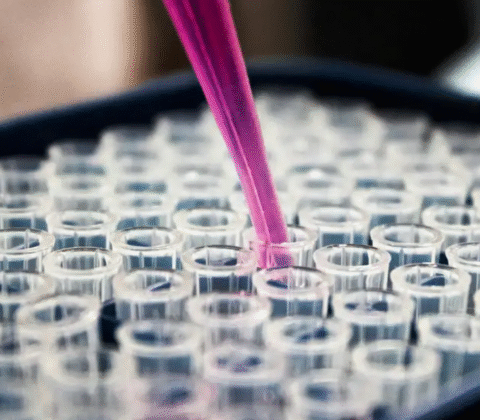 Imagem do post Avanço: Exame de sangue pode diagnosticar Alzheimer