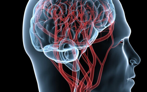 Imagem do post Novo estudo alerta para aumento de casos de AVC no Brasil