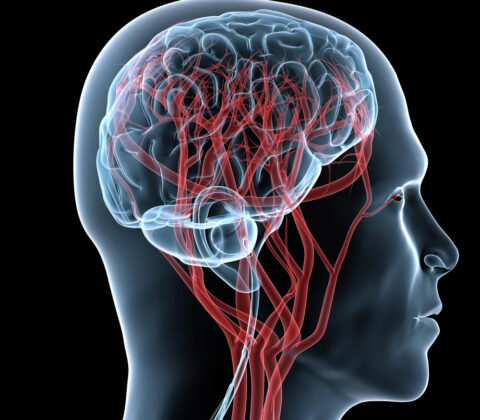 Imagem do post Novo estudo alerta para aumento de casos de AVC no Brasil