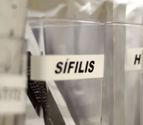 Imagem do post Transmissão vertical de sífilis aumenta no Brasil