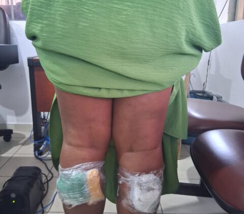 Imagem do post Cinco visitantes são detidas após tentarem entrar com drogas nas panturrilhas