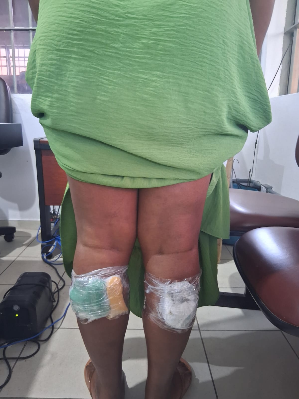 Cinco visitantes são detidas após tentarem entrar com drogas nas panturrilhas