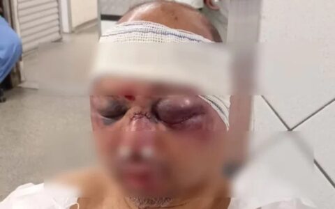 Imagem do post Rodoviário é espancado por traficantes após denúncia de adolescente