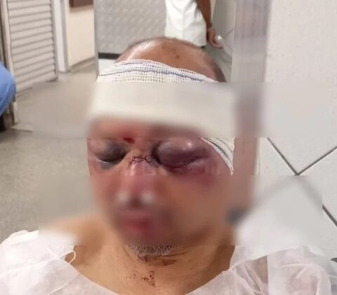 Imagem do post Rodoviário é espancado por traficantes após denúncia de adolescente
