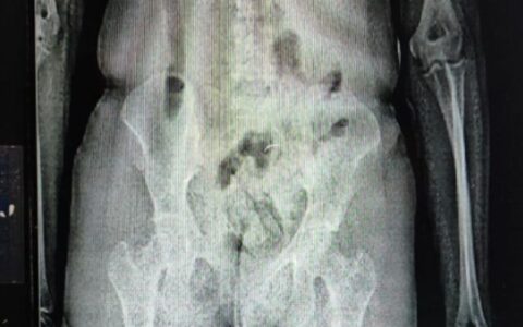 Imagem do post Eunápolis: mulher tenta entrar em presídio com drogas nas partes íntimas e é presa