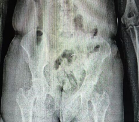 Imagem do post Eunápolis: mulher tenta entrar em presídio com drogas nas partes íntimas e é presa