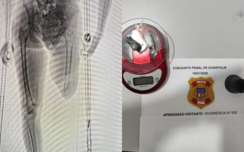 Imagem do post Mulher tenta entrar no presídio com drogas escondida em muleta