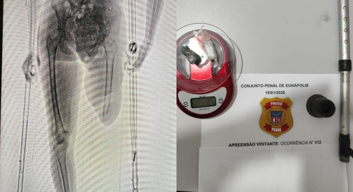 Mulher tenta entrar no presídio com drogas escondida em muleta