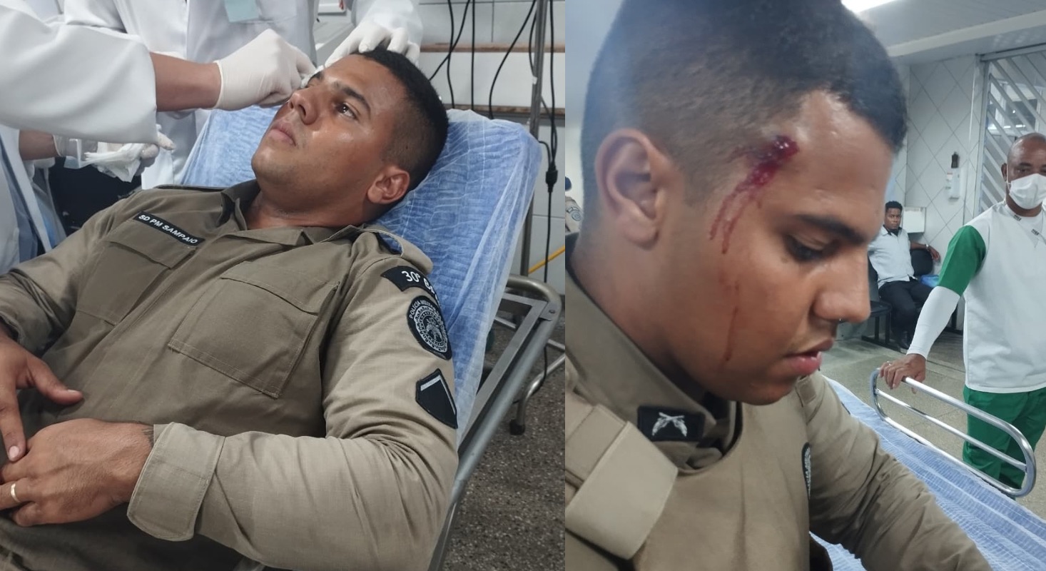 Urgente: Policial é ferido durante troca de tiros com o CV