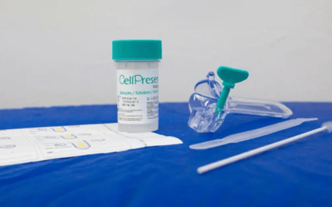 Imagem do post SUS atualiza rastreamento do câncer de colo do útero; saiba mais