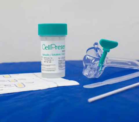 Imagem do post SUS atualiza rastreamento do câncer de colo do útero; saiba mais