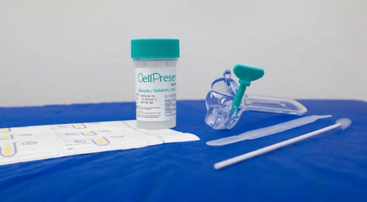 SUS atualiza rastreamento do câncer de colo do útero; saiba mais