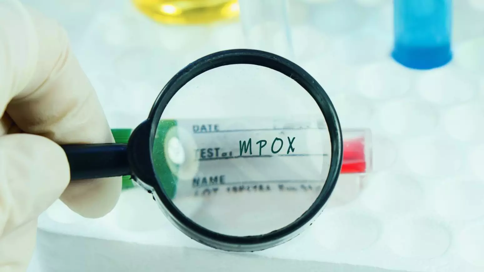 Mpox acende alerta no Brasil: como o vírus se espalha, quais os sintomas e quando buscar ajuda