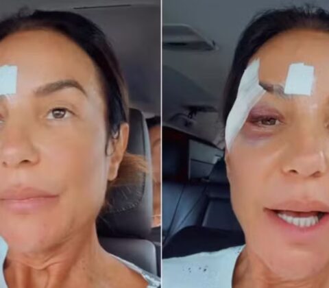 Imagem do post Ivete Sangalo recebe alta hospitalar após desmaio: “Estou ótima”