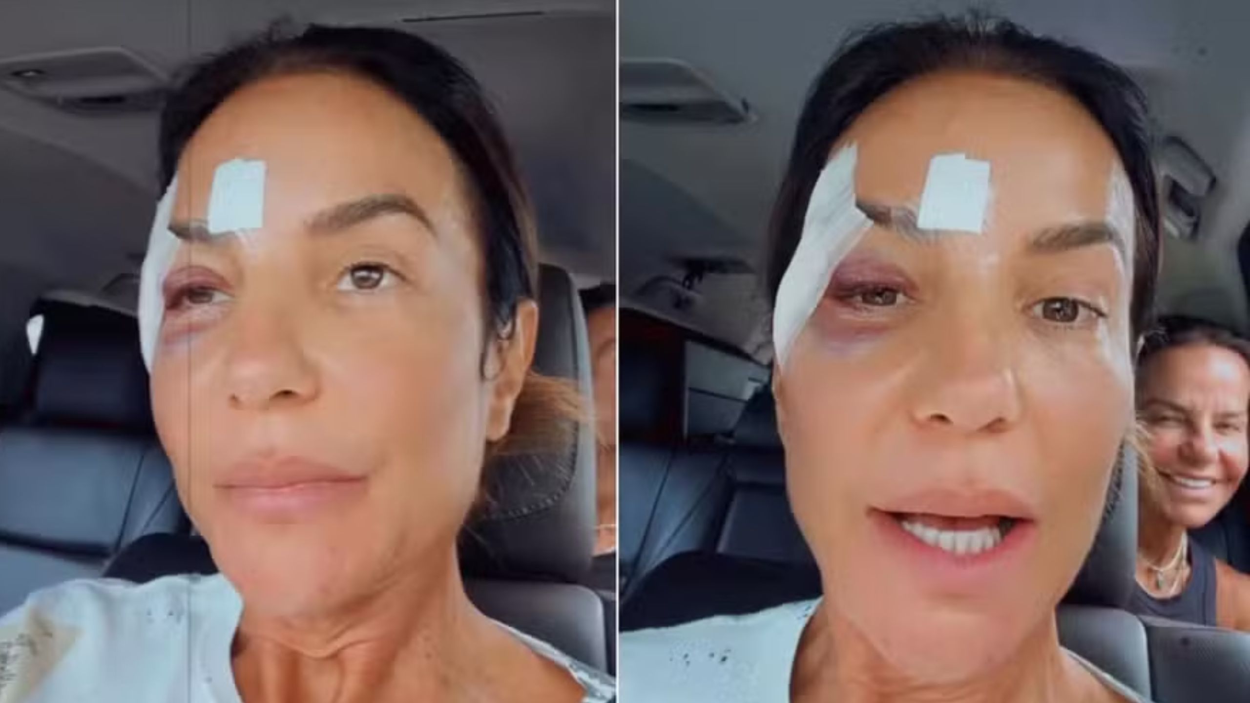 Ivete Sangalo recebe alta hospitalar após desmaio: “Estou ótima”