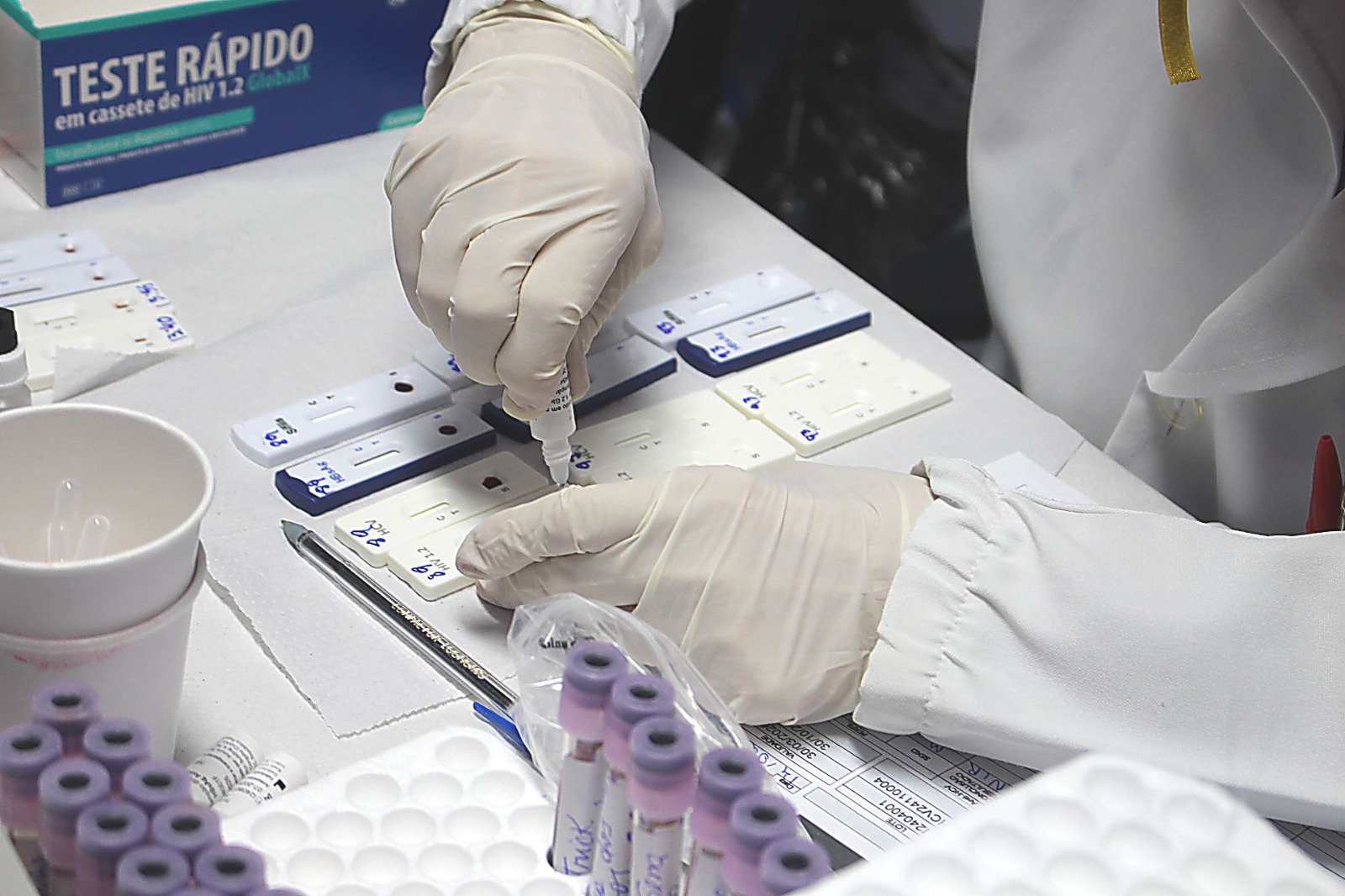 Mutirão contra hepatites virais leva testagem e vacinação ao Subúrbio de Salvador neste sábado