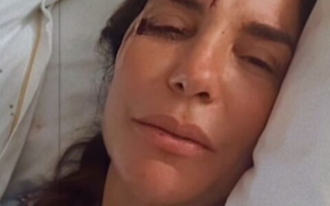 Imagem do post Ivete Sangalo passa por cirurgia; saiba o estado de saúde